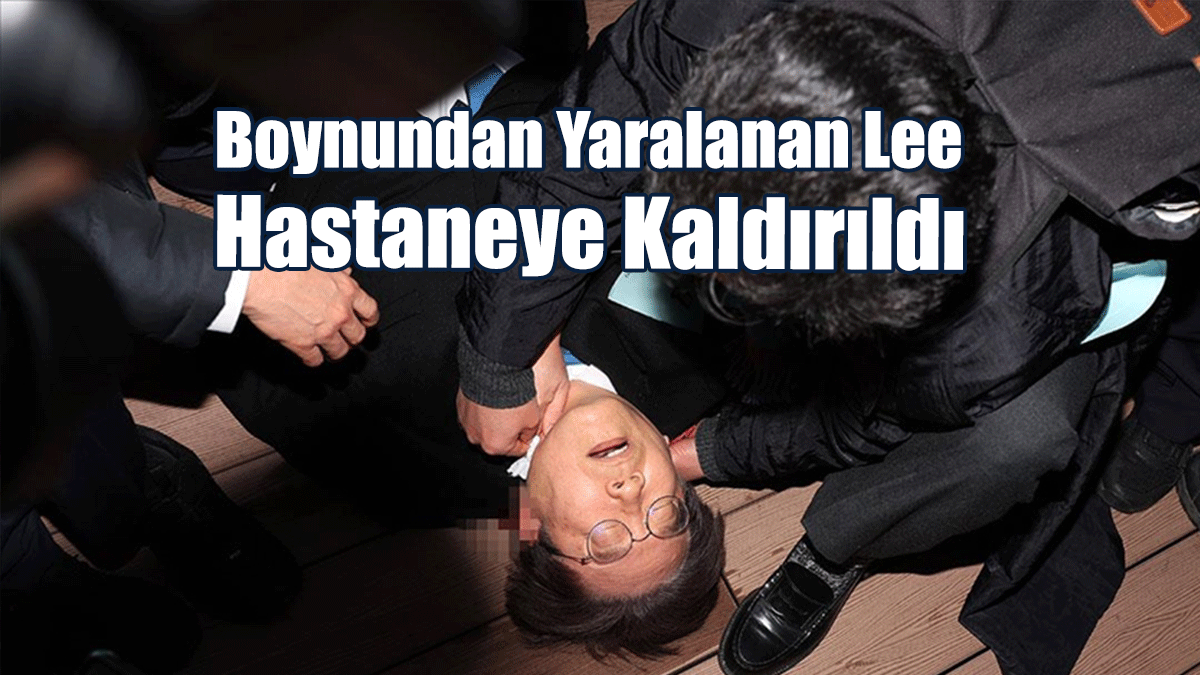 Güney Kore'de Ana Muhalefet Lideri Bıçaklı Saldırıya Uğradı!