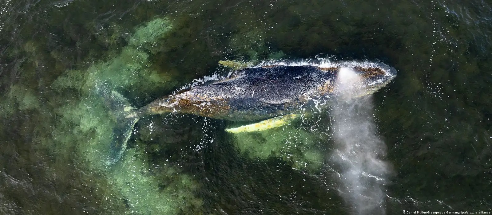 Yaşam mücadelesi veren Timmy için son umut: Milyonerler seferber oldu