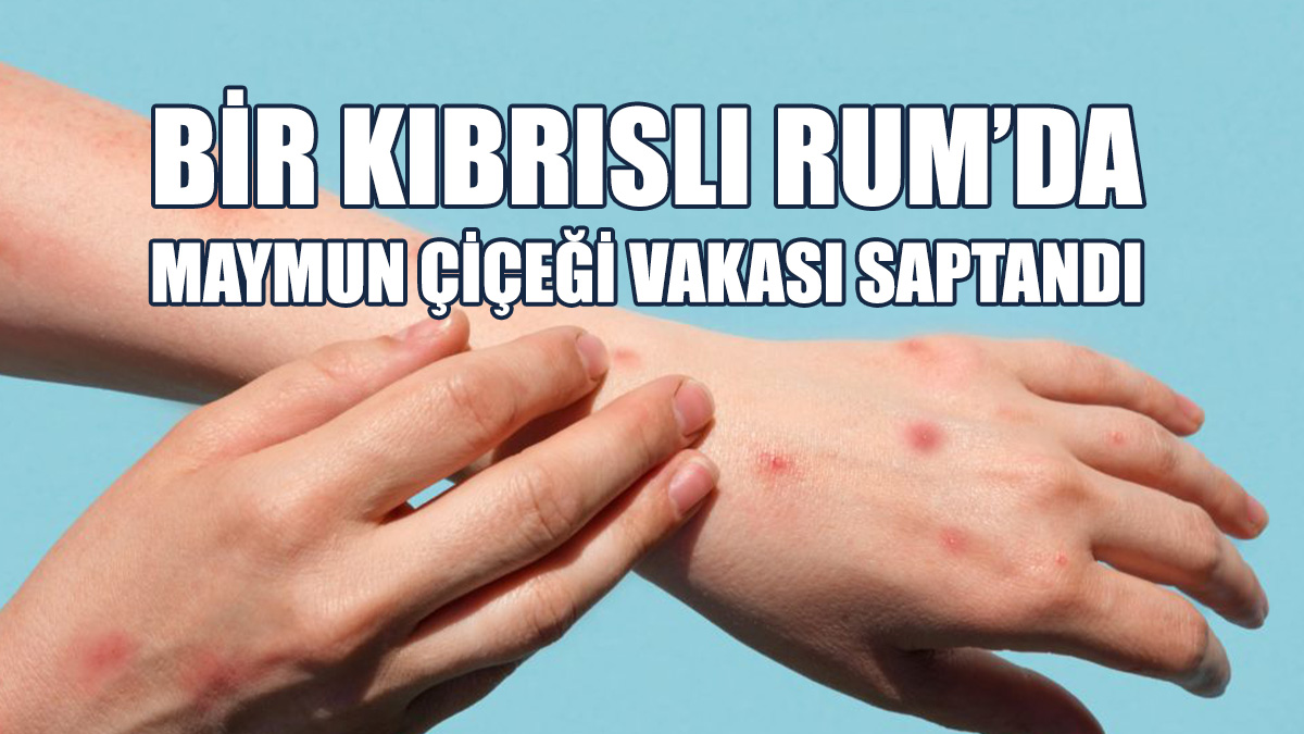 Rum Sağlık Bakanlığı Alarma Geçti