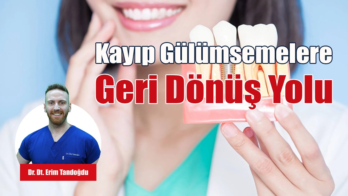 İmplant Tedavisi: Kayıp Gülümsemelere Geri Dönüş Yolu