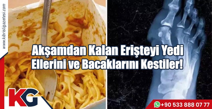 Akşamdan Kalan Erişteyi Yedi Ellerini ve Bacaklarını Kestiler!