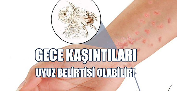 Uzmanlardan ‘Uyuz’ Uyarısı!