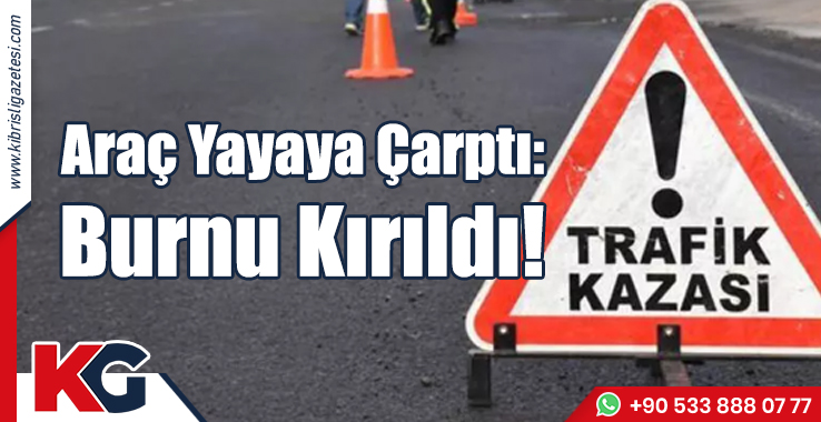 Araç Yayaya Çarptı: Burnu Kırıldı!