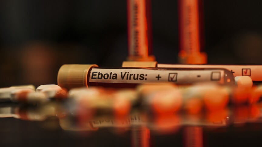 ABD'de bazı havalimanlarında Ebola tarama merkezleri kurulacak