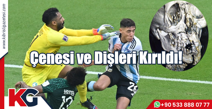 Çenesi ve Dişleri Kırıldı!