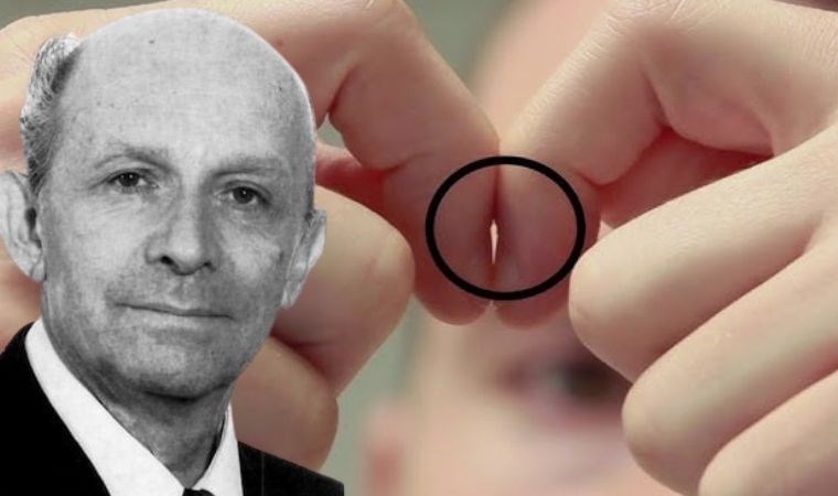 Bu basit parmak testi hastalıkları ortaya çıkarıyor!