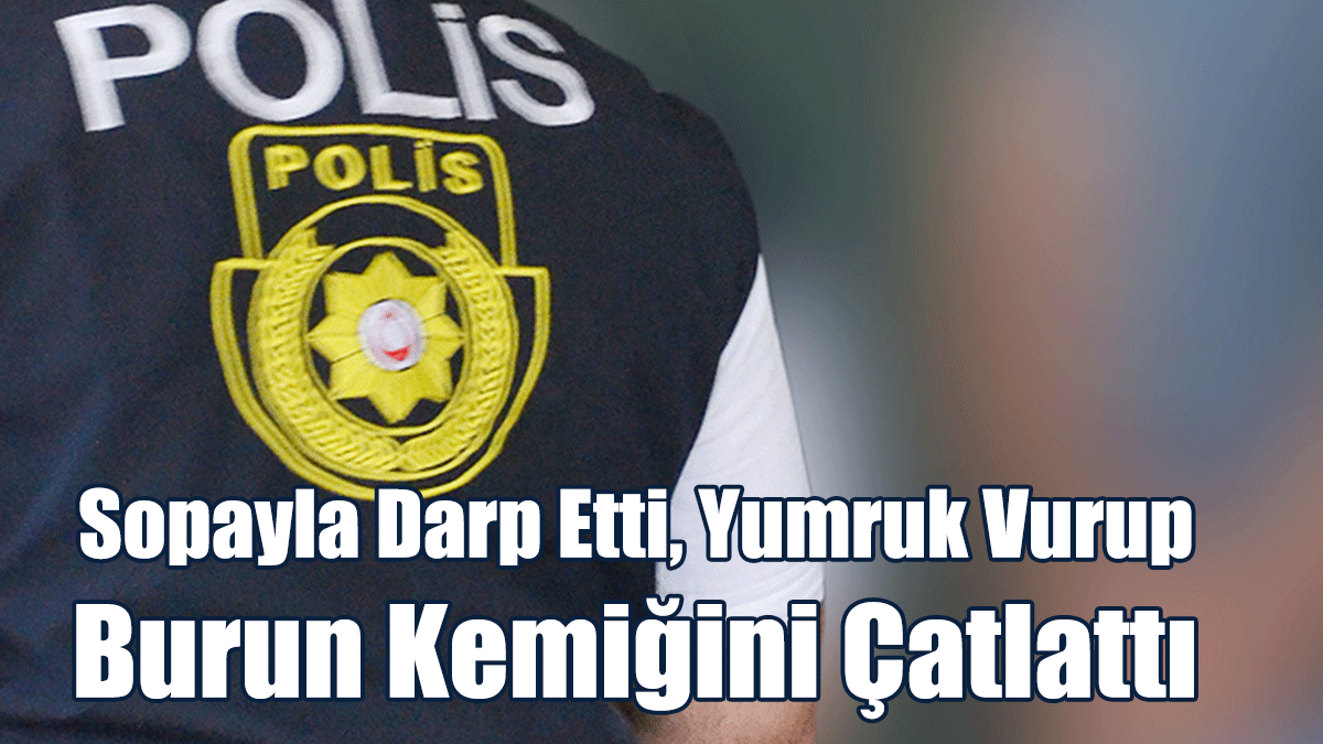 Sopayla Darp Etti, Yumruk Vurup Burun Kemiğini Çatlattı