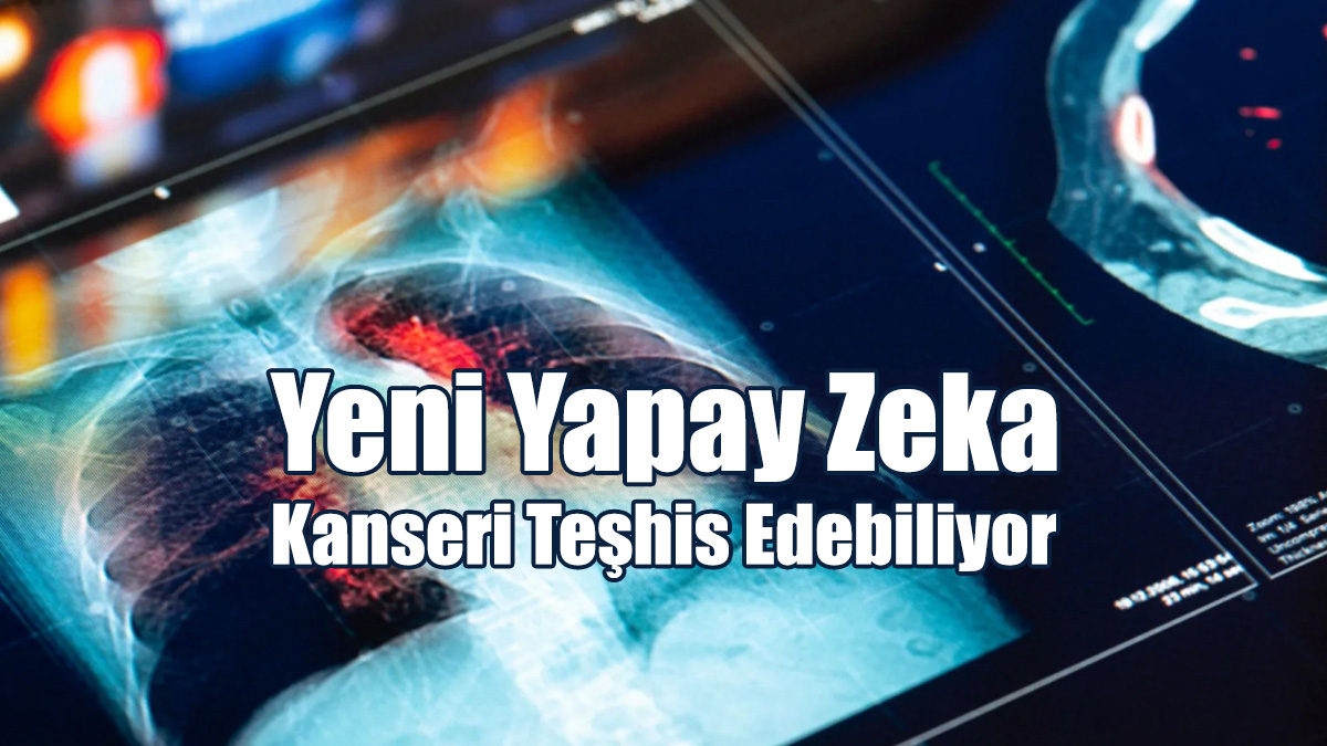 Yeni Yapay Zeka Kanseri Teşhis Edebiliyor