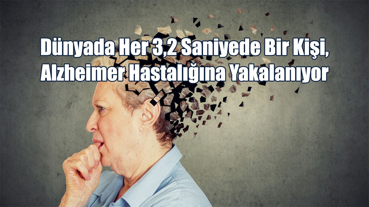 Dünyada Her 3,2 Saniyede Bir Kişi, Alzheimer Hastalığına Yakalanıyor