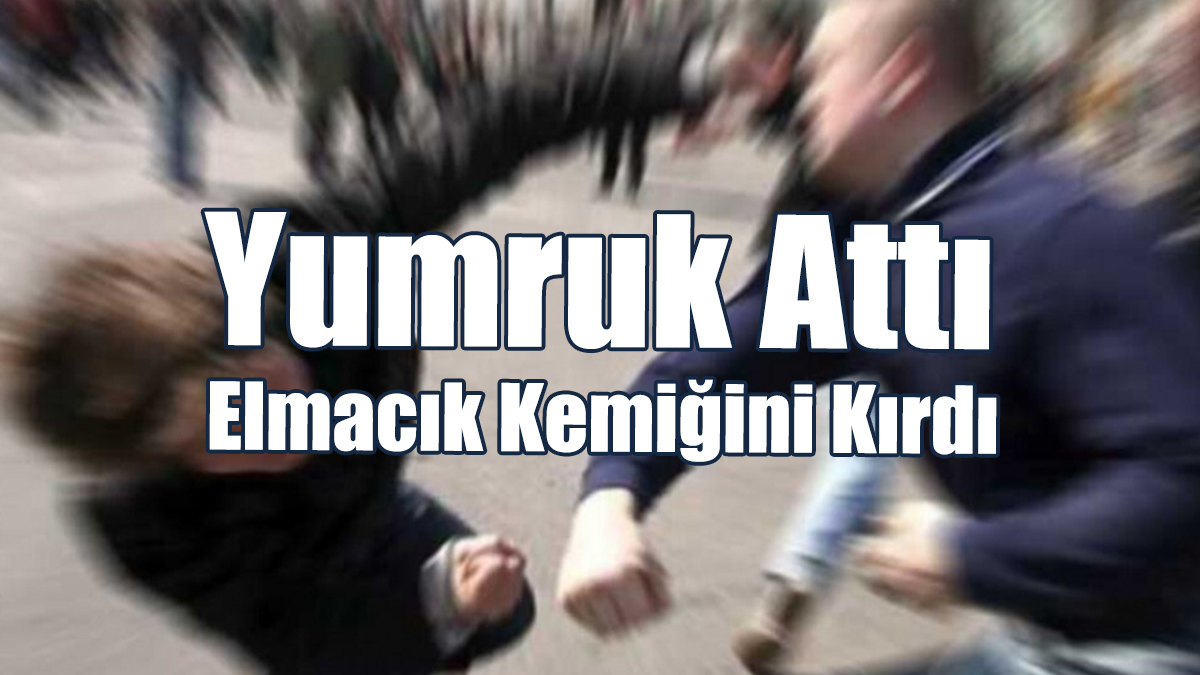 Yumruk Attı Elmacık Kemiğini Kırdı