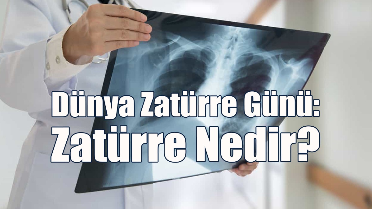Zatürre Aşısı Olmalı mıyım?