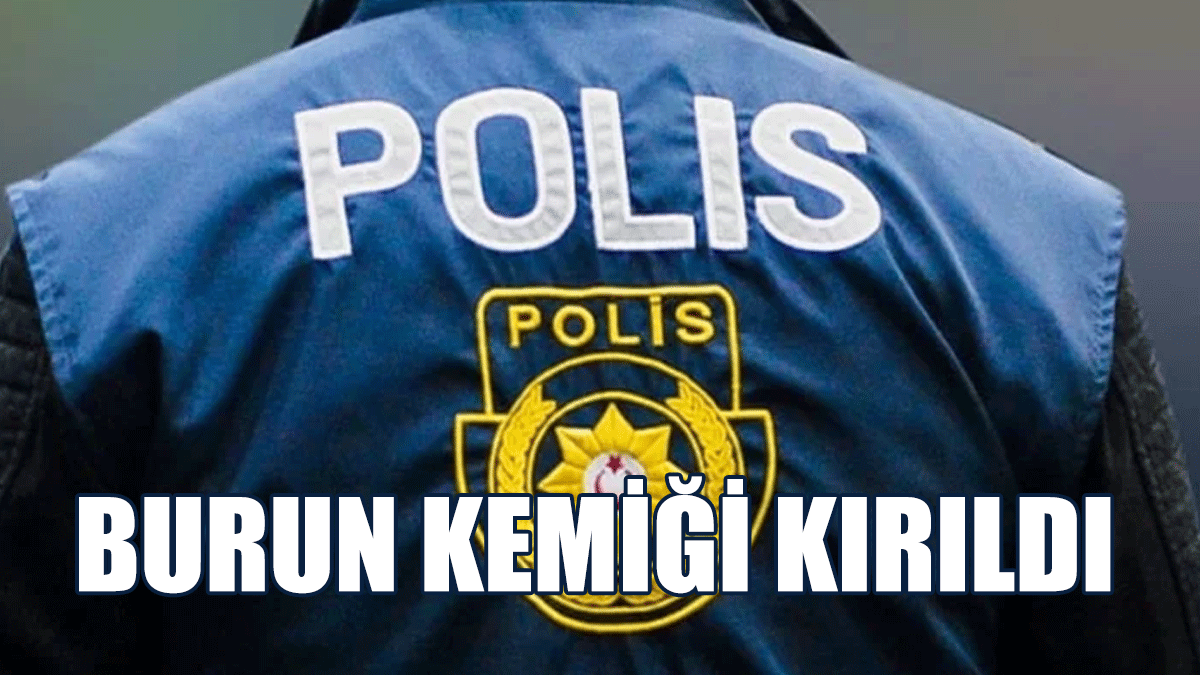 Gazimağusa’da Vahim Zarar Ve Ciddi Darp