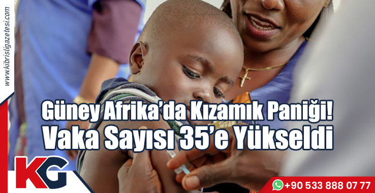 Güney Afrika'da Kızamık Paniği! Vaka Sayısı 35'e Yükseldi