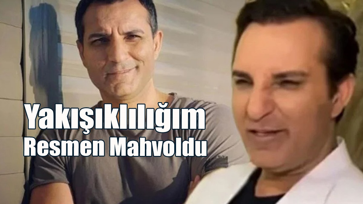 Rafet El Roman'ın Estetik Pişmanlığı: Yakışıklılığım Resmen Mahvoldu