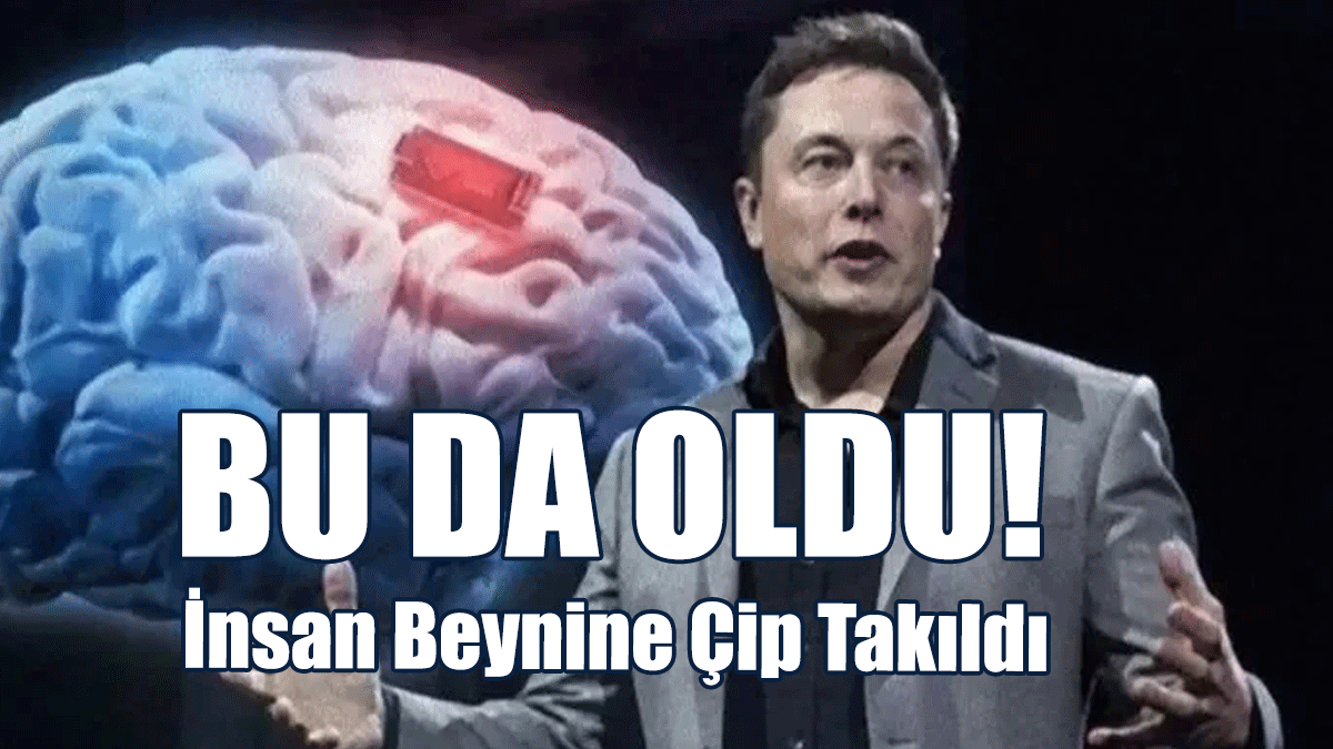 İlk Kez İnsan Beynine Çip Takıldı