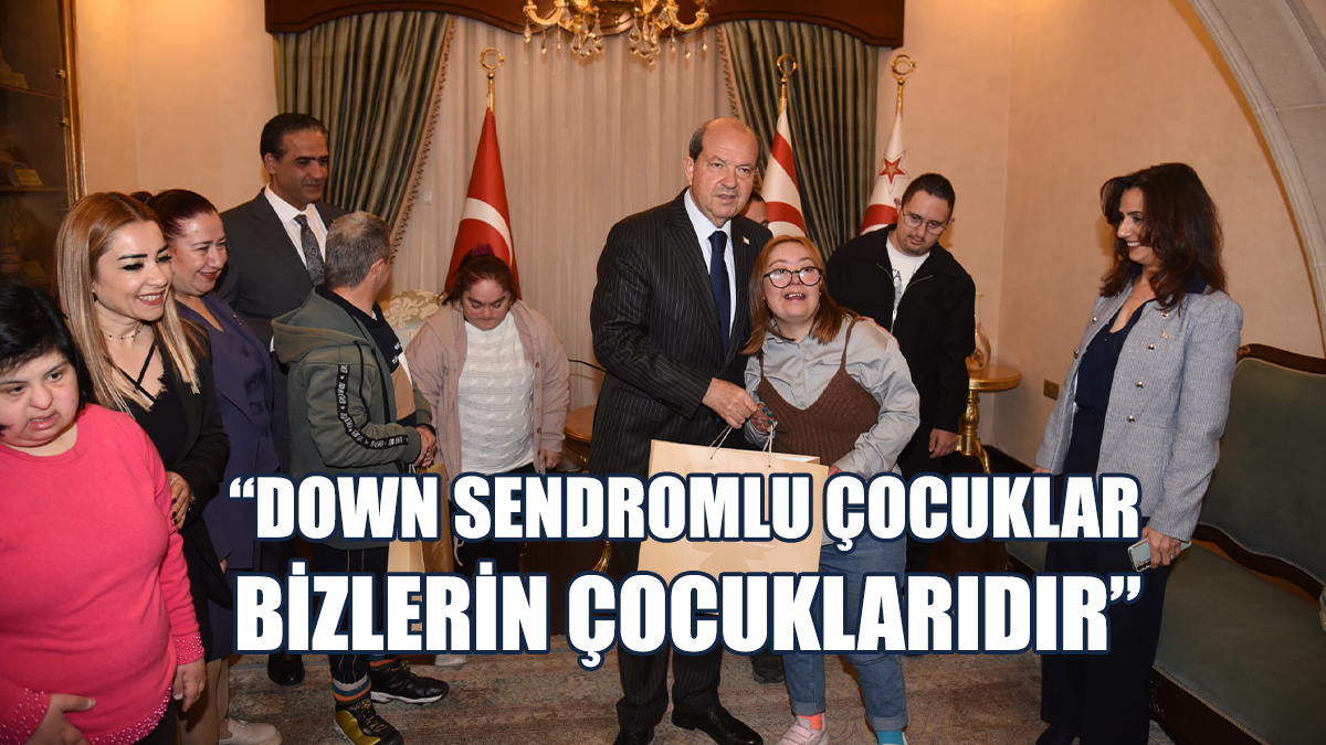 Tatar, Down Sendromlu Çocukları Kabul Etti