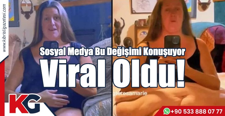 Sosyal Medya Bu Değişimi Konuşuyor! Viral Oldu!