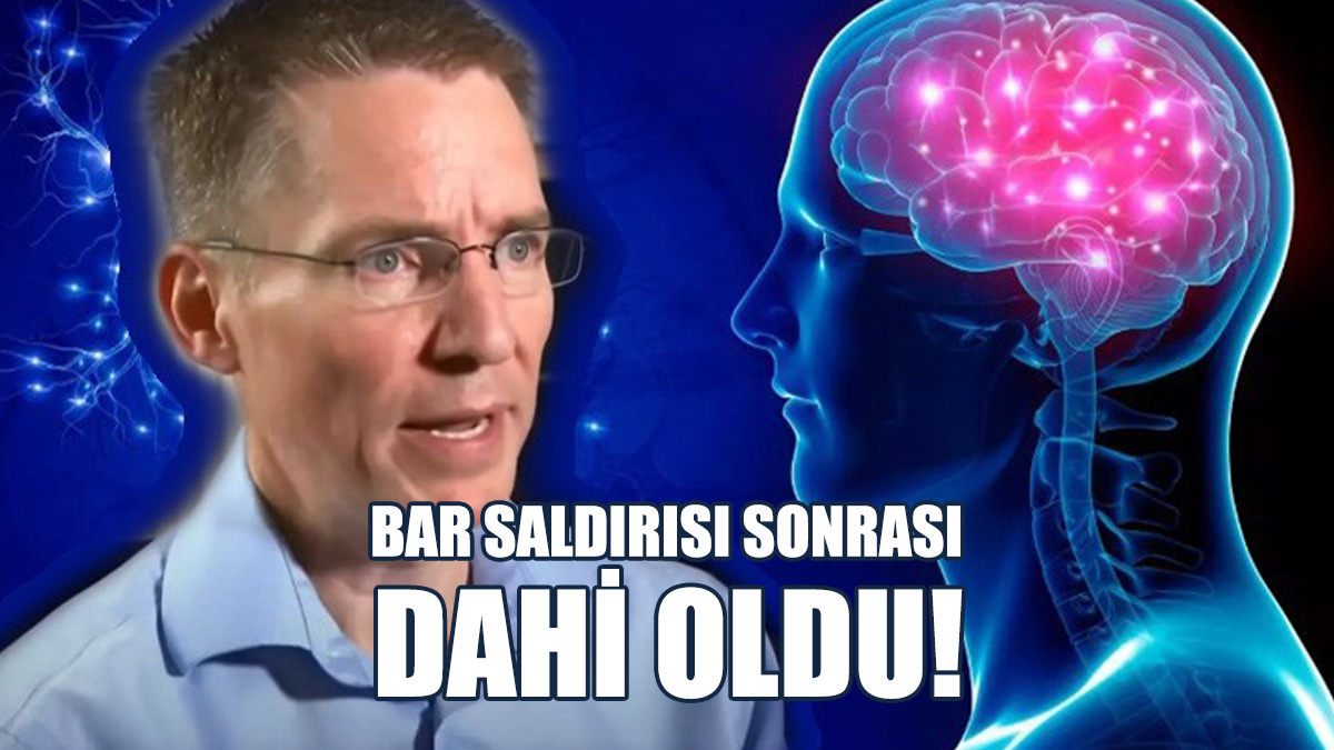 Kazanılmış Savant Sendromu Nedir?