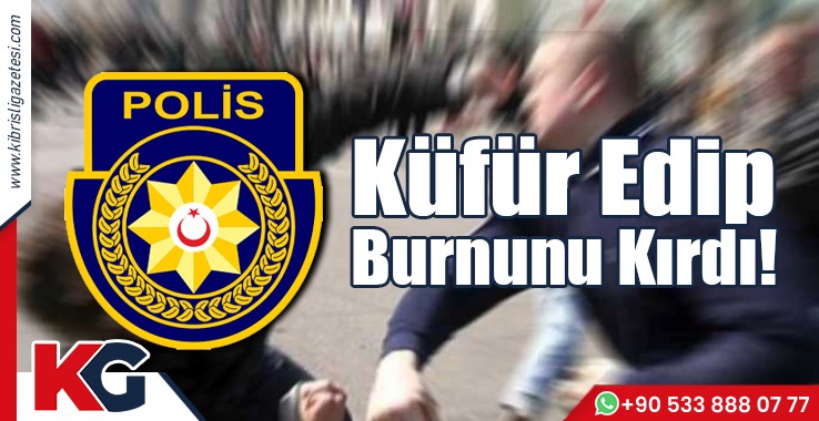 Küfür Edip, Burnunu Kırdı!