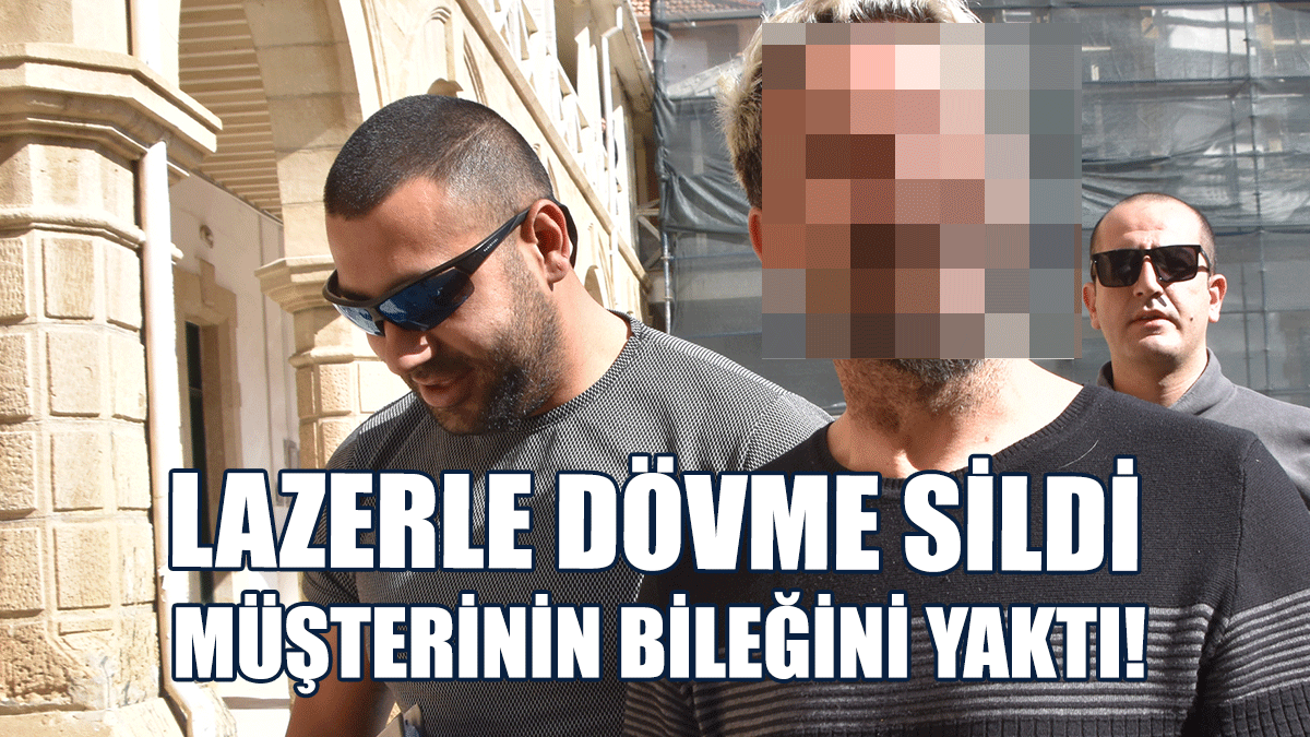 Lazerle Dövme Sildi, Müşterinin Bileğini Yaktı!