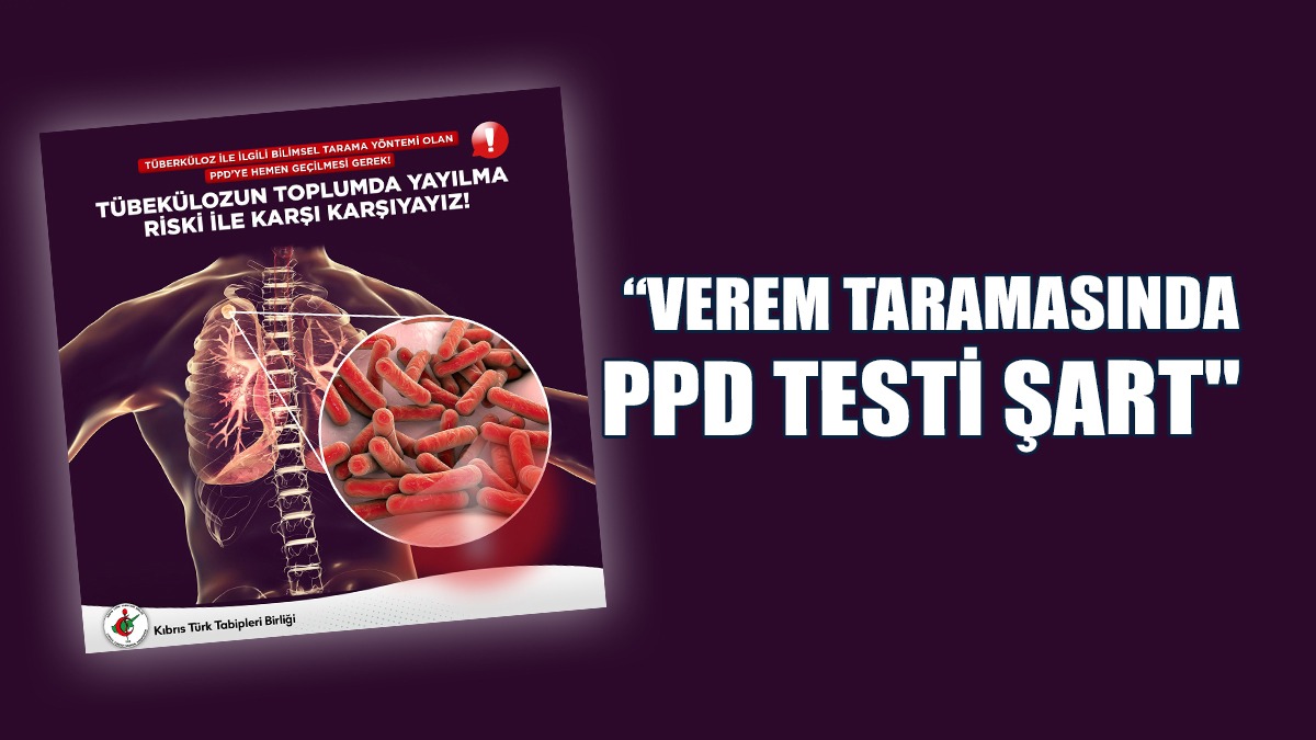 Kıbrıs Türk Tabipleri Birliği: Verem Taramasında PPD Testi Şart