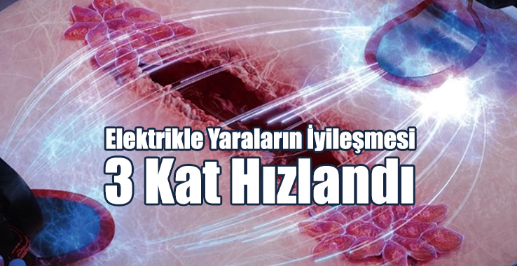 Elektrikle Yaraların İyileşmesi 3 Kat Hızlandı