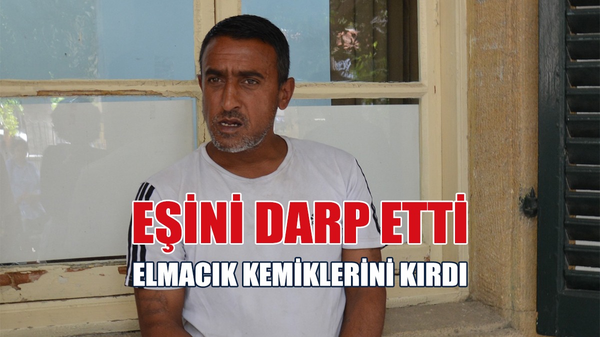 Maddi Sebeplerle Aralarında Tartışma Çıktı, Eşini Darp Etti