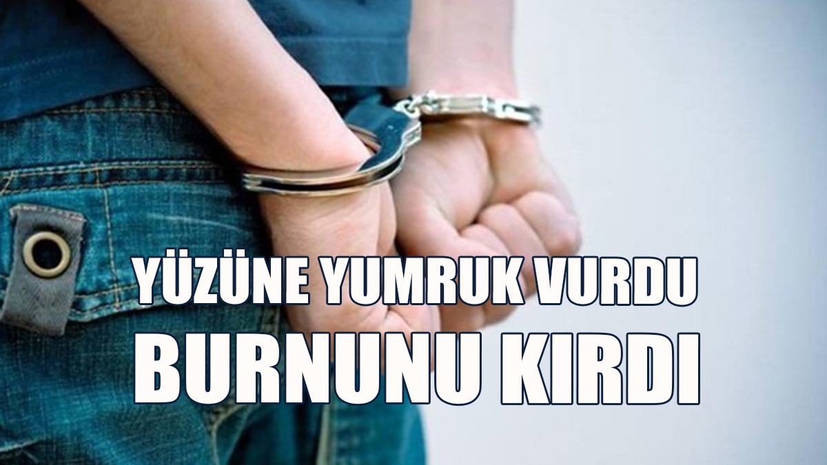 Ayırmak İçin Araya Girdi Yumruk Yedi..