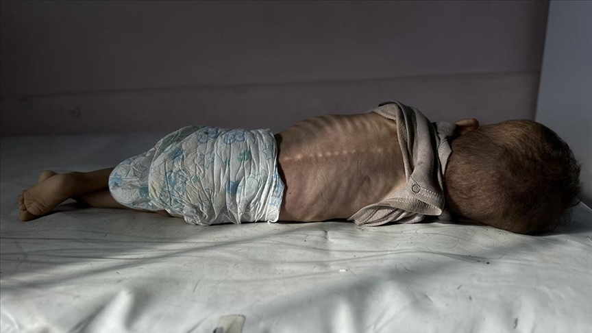 "Gazze'de her 5 çocuktan 1'i akut yetersiz beslenme sorunu yaşıyor"