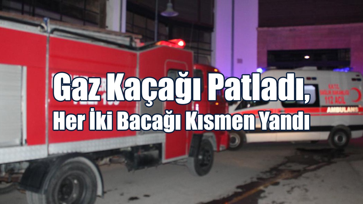 Gaz Kaçağı Patladı, Her İki Bacağı Kısmen Yandı