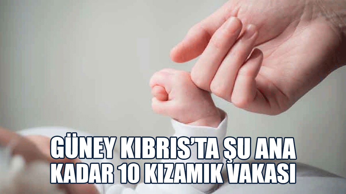 Güney Kıbrıs’ta Şu Ana Kadar 10 Kızamık Vakası Tespit Edildi