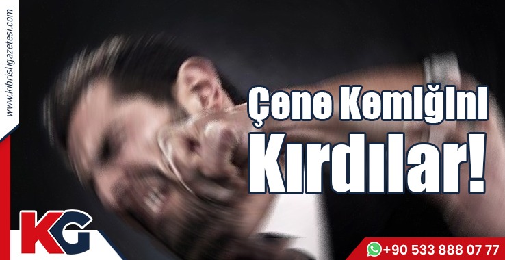 Çene Kemiğini Kırdılar!