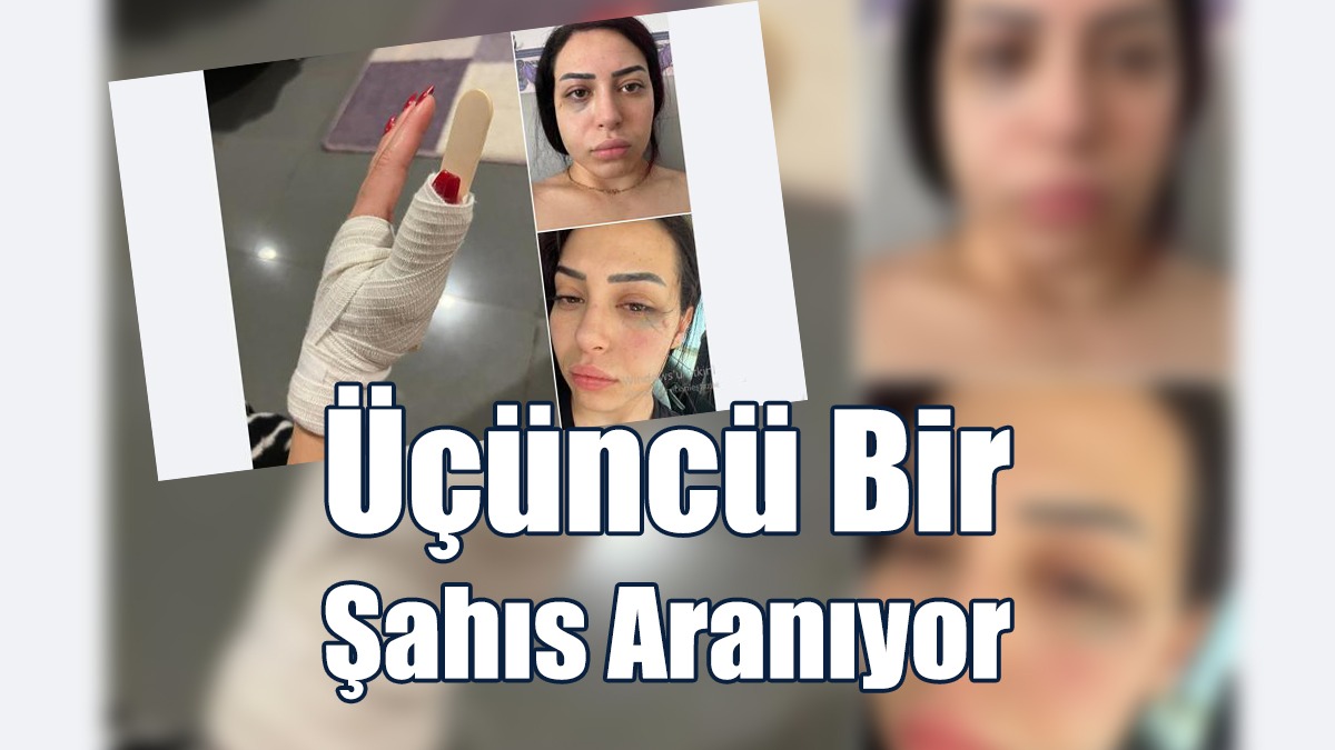 Kıbrıslı Türk Genç Kızın Darp Edilmesi Olayında Üçüncü Bir Şahıs Aranıyor