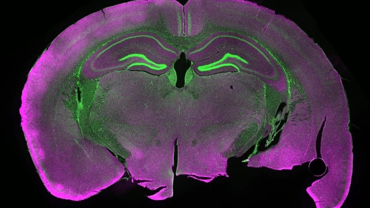 Devrim yaratacak keşif! Fare beyin dokusunu dondurdular, ortaya çıkan sonuç şaşırttı