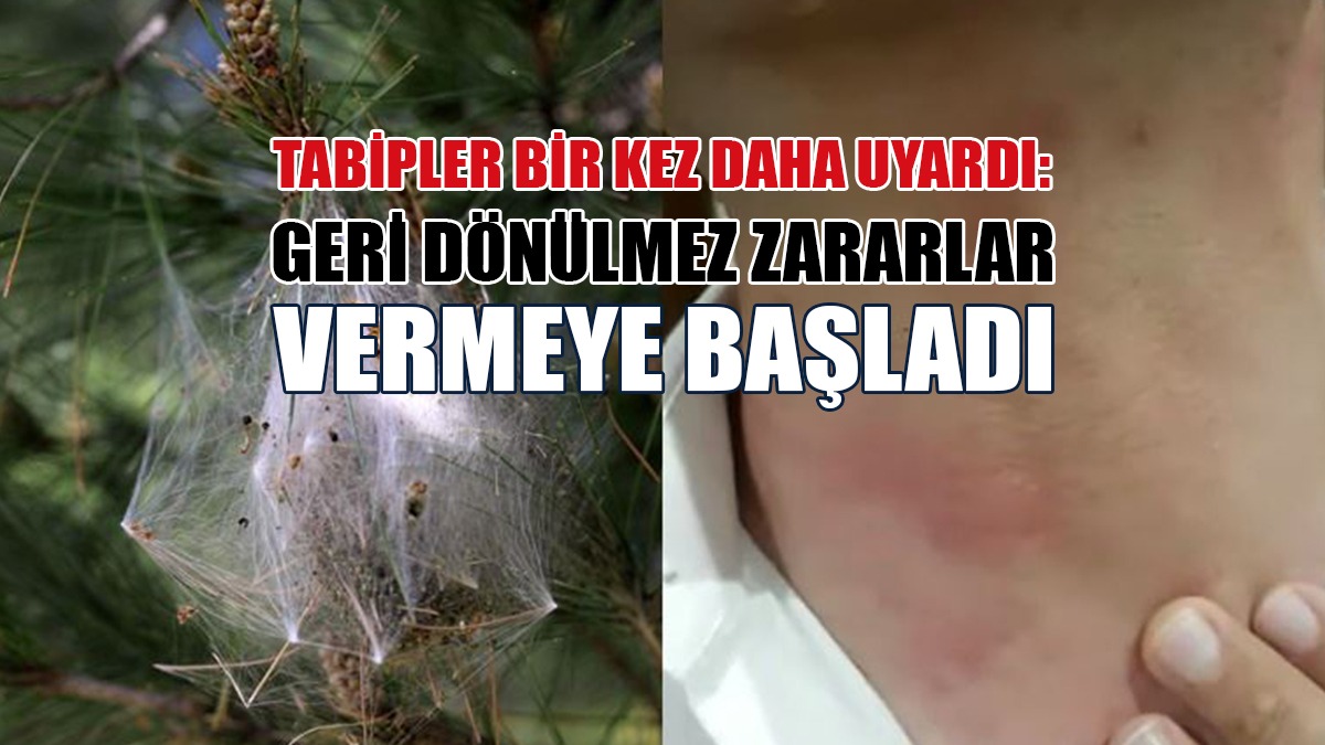 Çam Kese Böceği İnsan Sağlığı İçin de Büyük Risk!