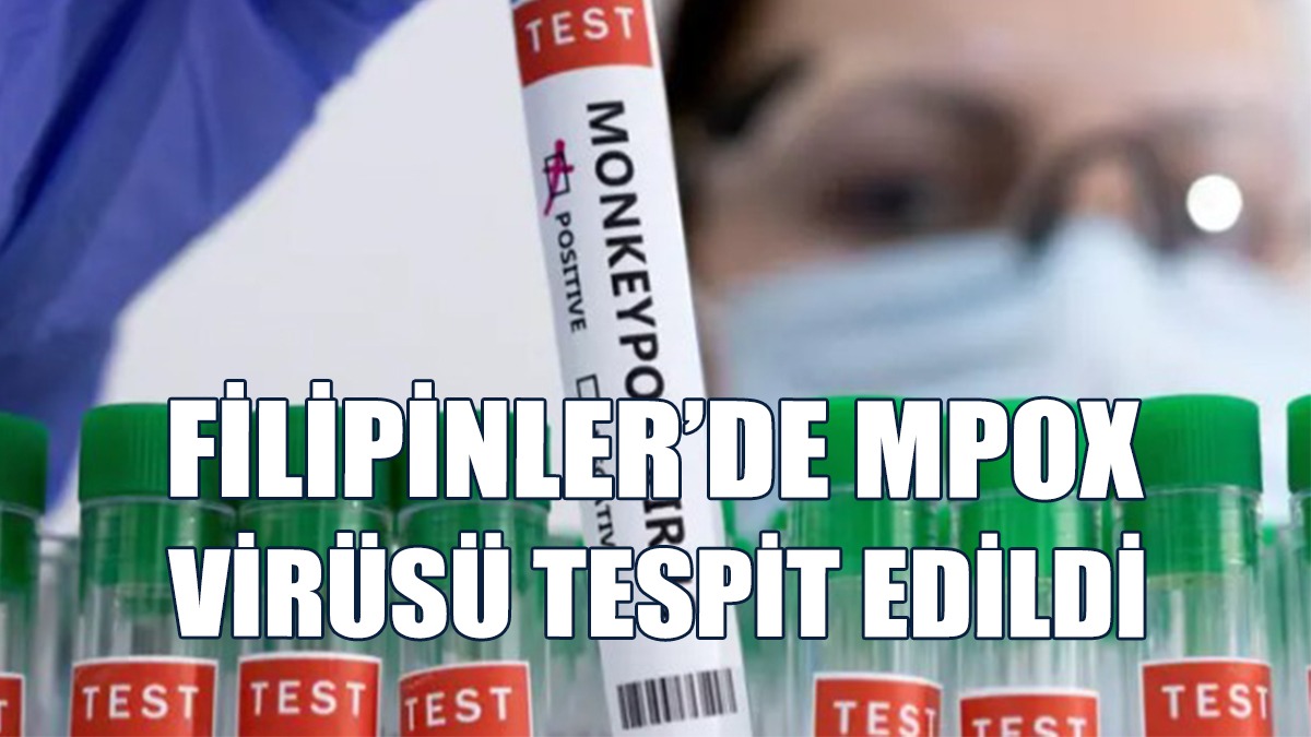 Endonezya'da Bu Yıl 14 Mpox Virüsü Tespit Edildi