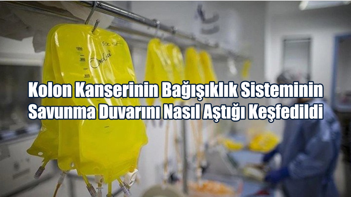 Kolon Kanserinin Bağışıklık Sisteminin Savunma Duvarını Nasıl Aştığı Keşfedildi