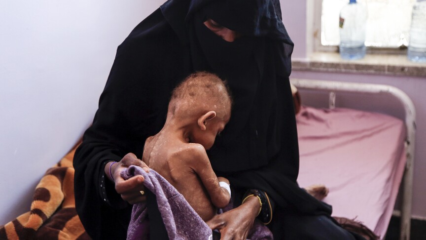 Yemen'de 18 milyondan fazla insan şiddetli açlık çekiyor