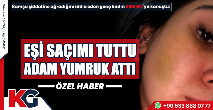 Anneannesi ile Birlikte Şiddete Uğrayan Kadın Darp Raporu Aldı!
