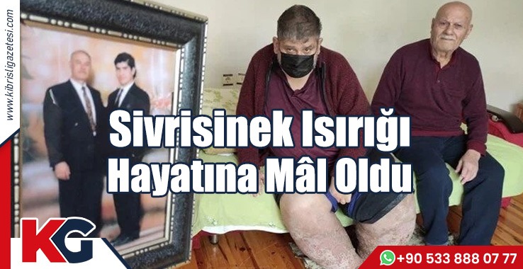 Sivrisinek Isırığı Hayatına Mâl Oldu