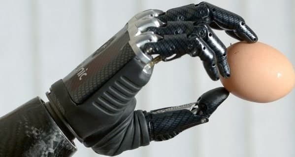 Güney Kıbrıs’ta bir hastaya biyonik el takıldı