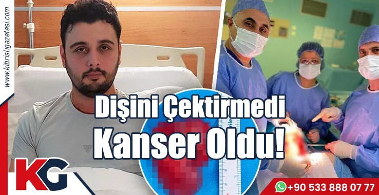 Dişini Çektirmedi Kanser Oldu!