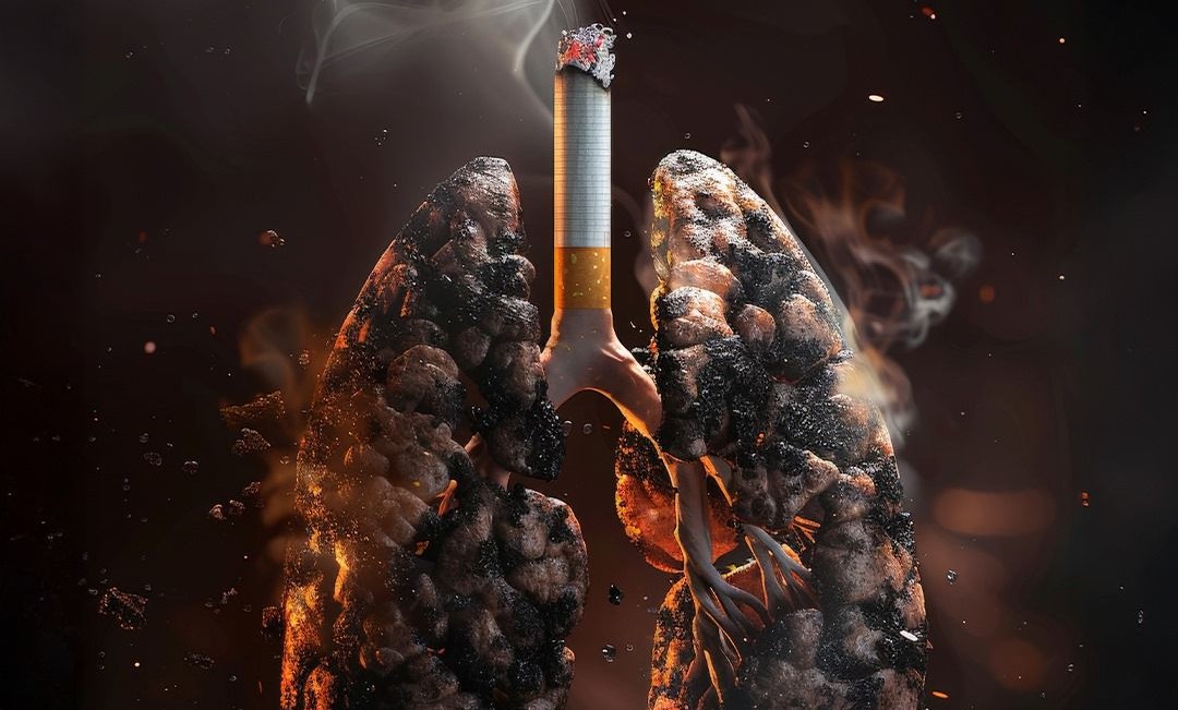 Tabipler Birliği: Akciğer kanseri hâlâ en çok can alan kanser türü