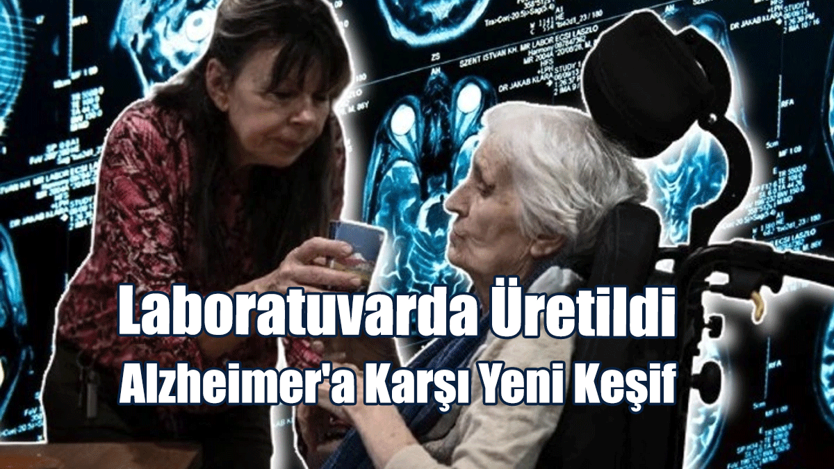 Laboratuvarda Üretildi: Alzheimer'a Karşı Yeni Keşif