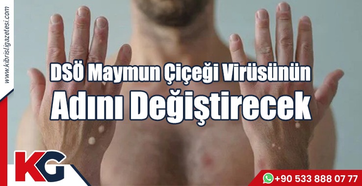 DSÖ Maymun Çiçeği Virüsünün Adını Değiştirecek