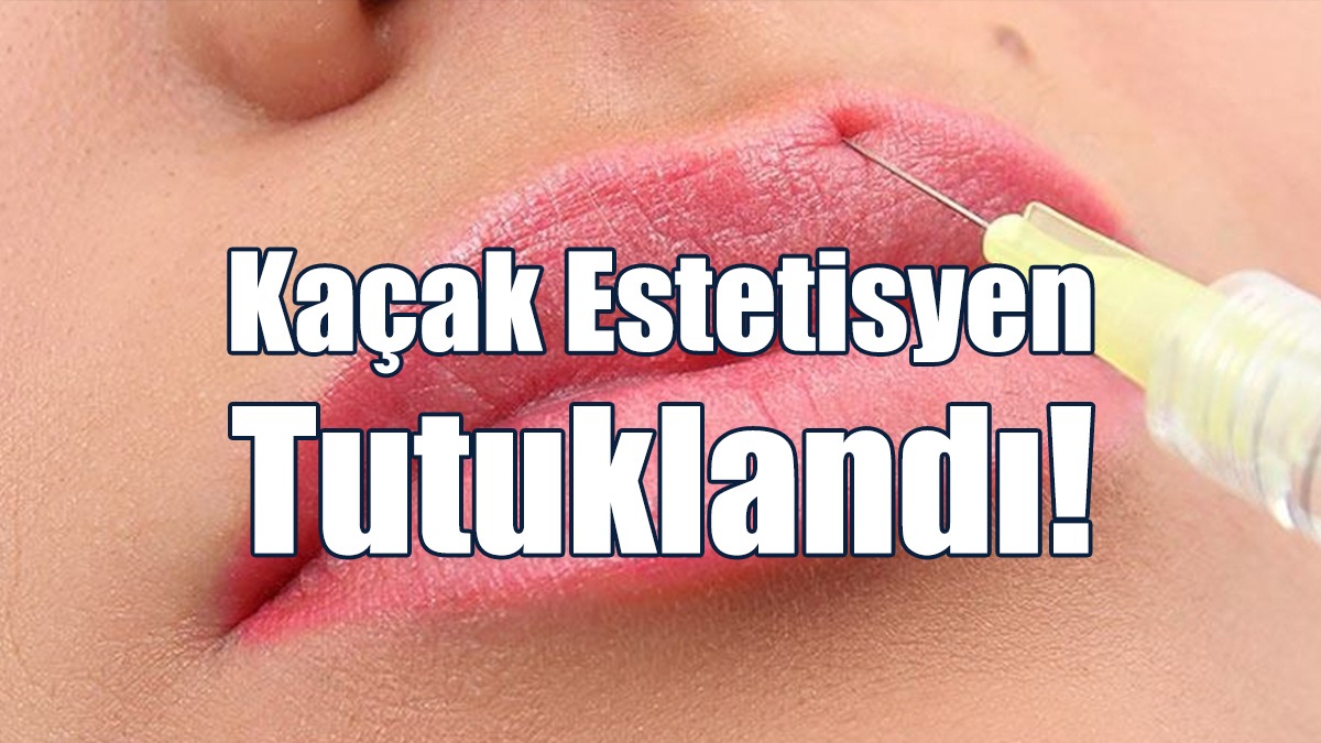 Girne’de İzinsiz Dudak Ve Çene Dolgusu İşlemi Yapan Şahıs Tutuklandı