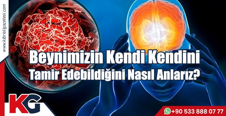 Beynimizin Kendi Kendini Tamir Edebildiğini Nasıl Anlarız?