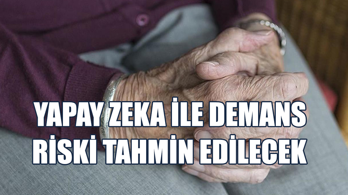 Bir Milyondan Fazla Beyin Taraması İncelenecek