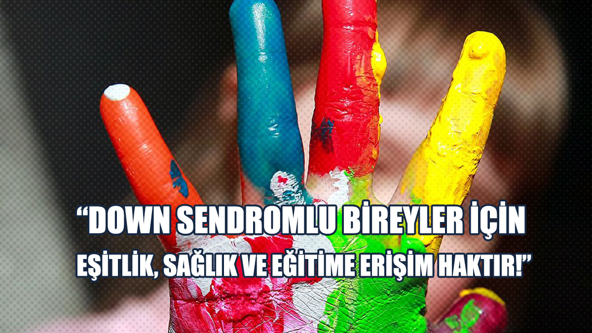 Tabipler Birliği'nden, Dünya Down Sendromu Farkındalık Günü Açıklaması