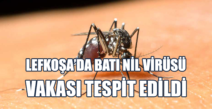 Lefkoşa’da Batı Nil Virüsü Vakası Tespit Edildi